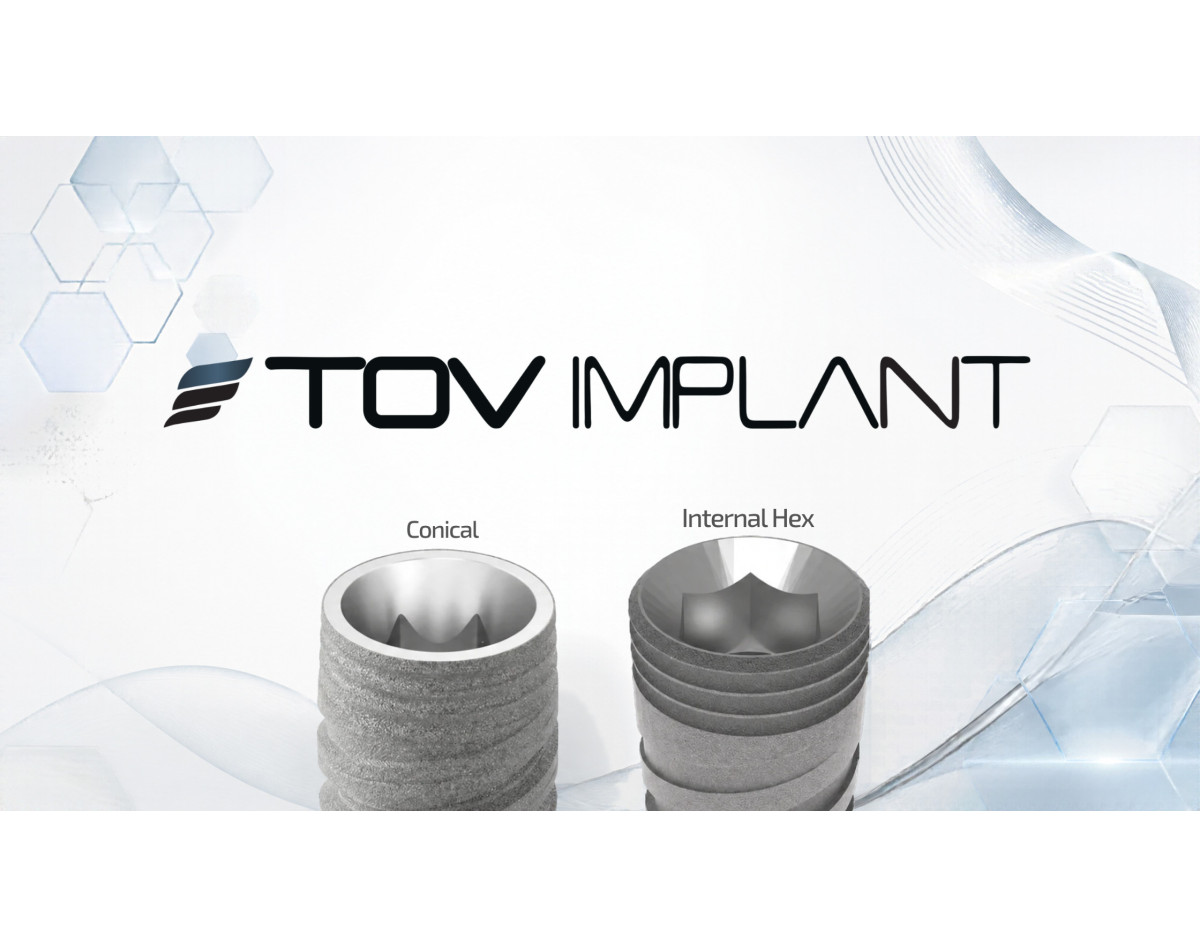 Connexion implant-pilier : comprendre les options